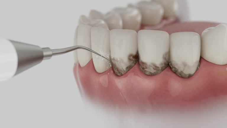 Reliable Emergency Dentist contractor in Natchitoches, LA by Smile Center Dentistry
